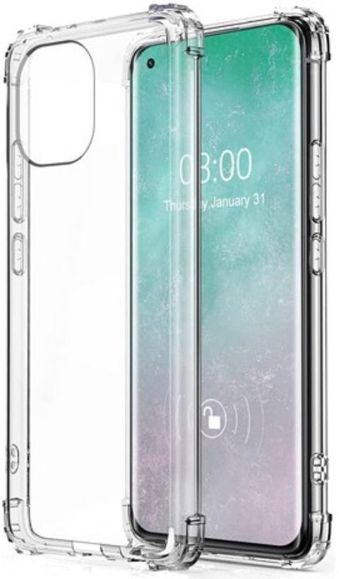 Shockproof Transparent Phone Case for Xiaomi Mi 11 - Clear - Brand New